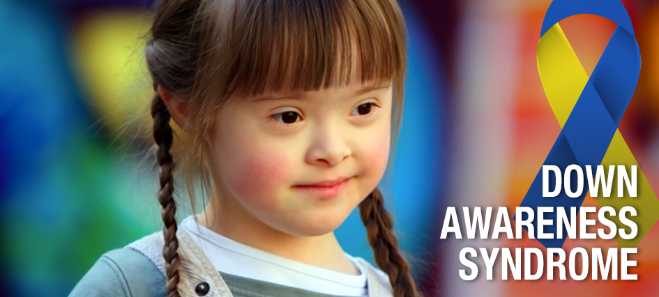 5 FAQs About Down Syndrome